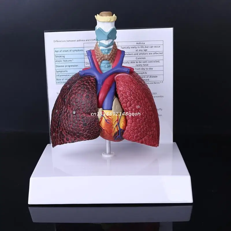 

Life Size Human Lung Model Anatomical Respiratory System Anatomy for Science Resources Study Display Teaching Too Dropship