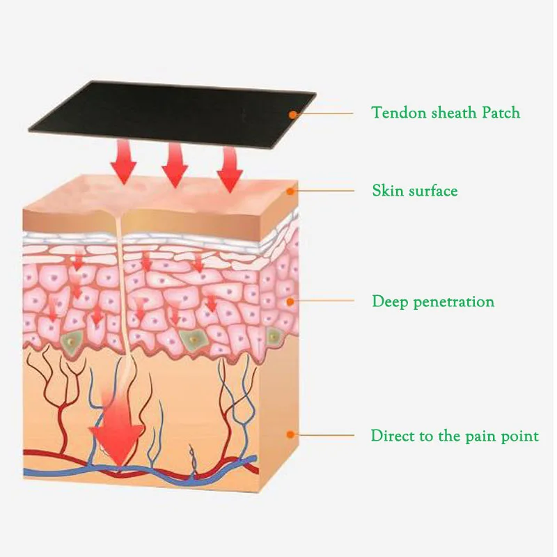 10 шт. пластыри для снятия симптомов боли в запястье | Красота и здоровье