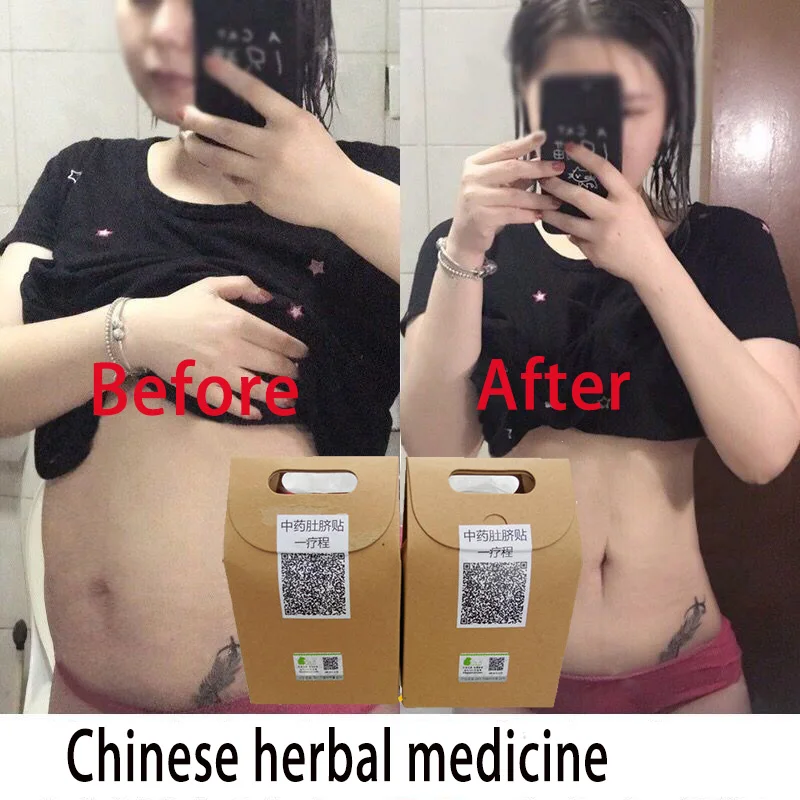 

80 шт., наклейка на пупок для похудения