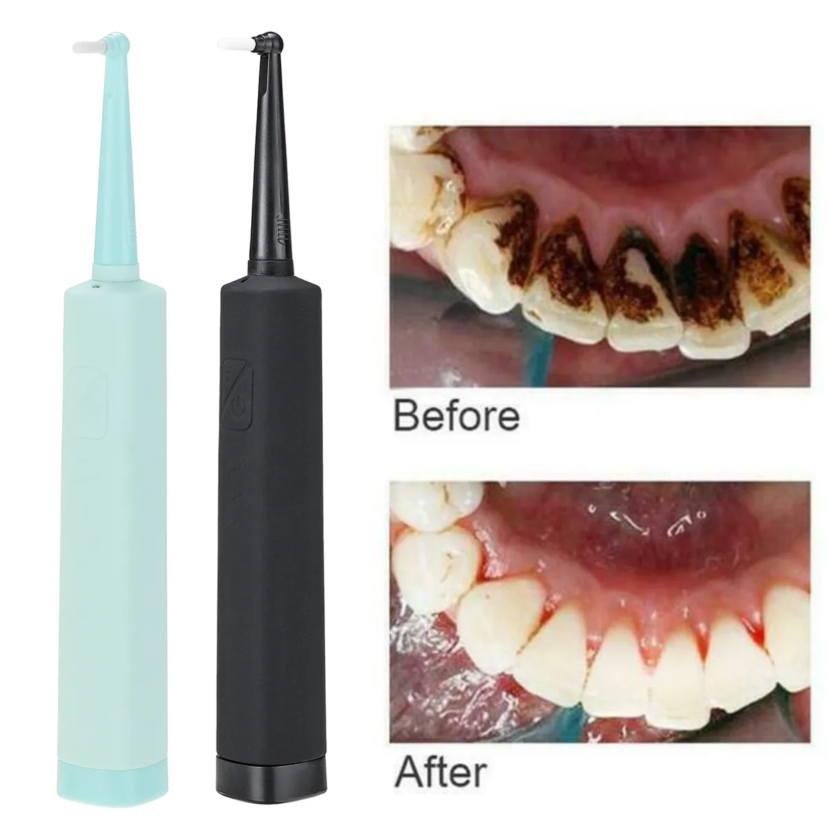 

Portable Electric Dental Calculus Remover Tool Kit High-Frequency Vibration Oral Cleaning Tartar Remover IPX6 Waterproof
