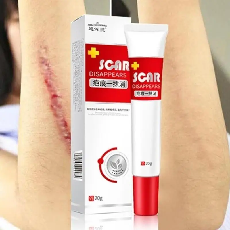 20ml Scar Treatment Cream Whitening Cream Skin Repair Repair Scar Treatment Face Stretch Acne Cream Cream A8X8