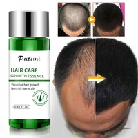 ginger fast growth essential oil serum moisturizing anti hair loss scalp repair care anti breaking prevent baldness treatment