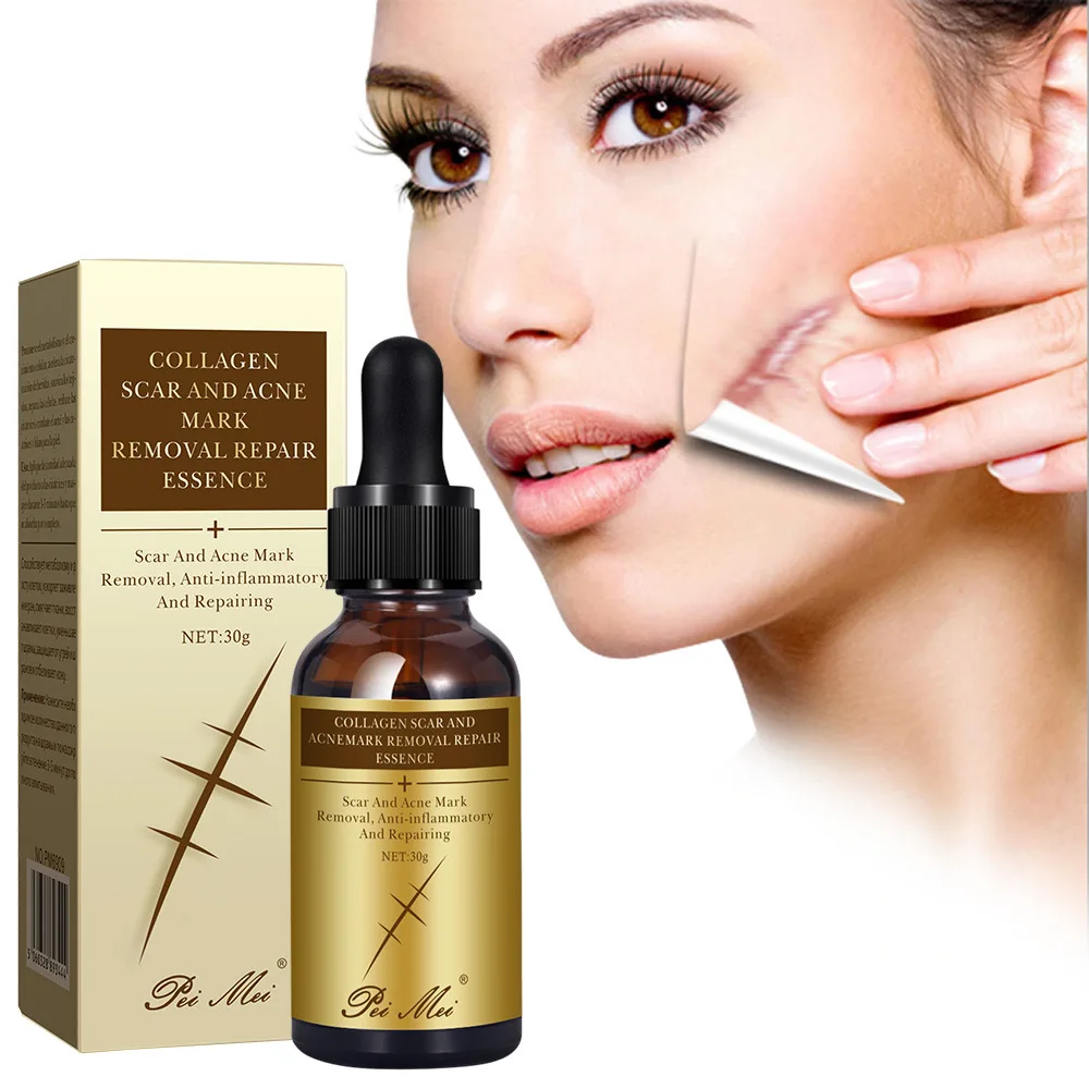 

30ML Collagen Scar Acne Mark Removal Repair Serum Tissue Soften Anti-Inflammatory Moisturizing Whitening Smooth Essence Skincare