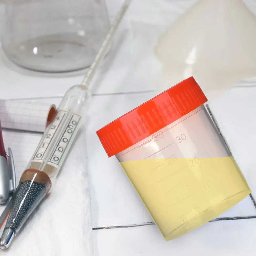 

50 Pcs/1 Pack 40ml Specimen Sampling Cup Practical Urine Sealed Container with Spiral Cover for Laboratory Use (Random