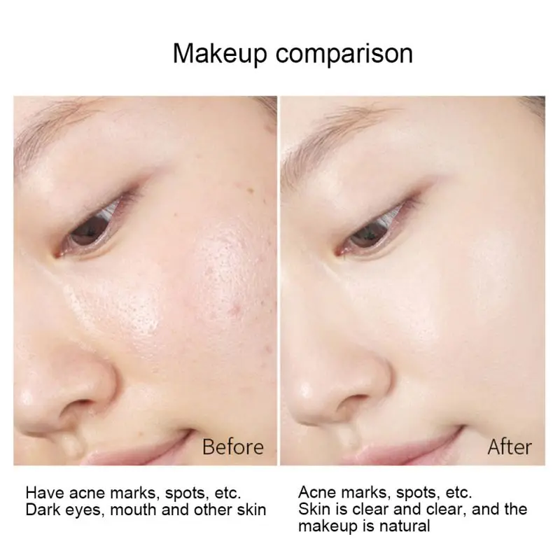 Профессиональная Палетка консилеров 14 г основа для коррекции веснушек точек