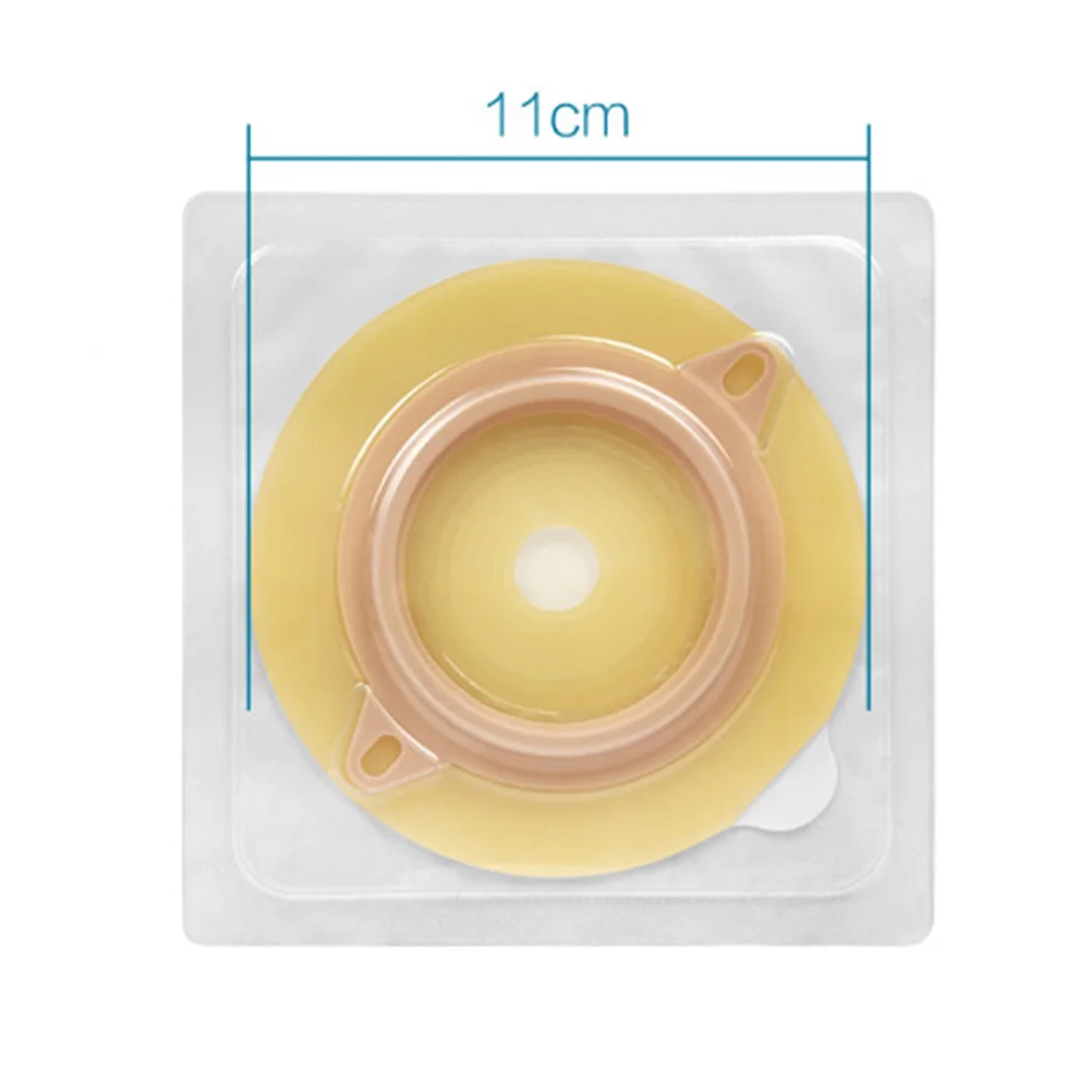 1 коробка из 5 эластичных барьерных полосок Ostomy шасси герметичное кольцо