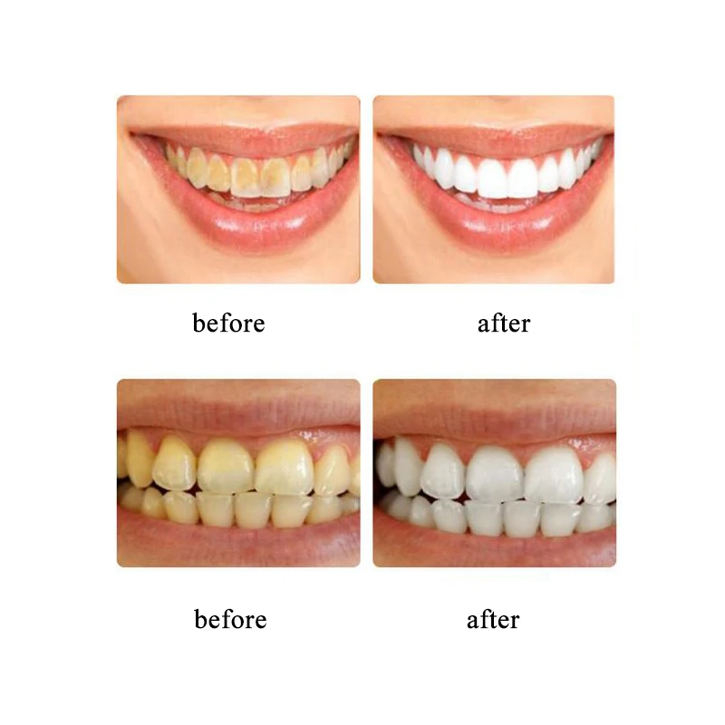 220 г пищевая Сода жидкая зубная паста Страсть фрукты черника удаление пятен зубы