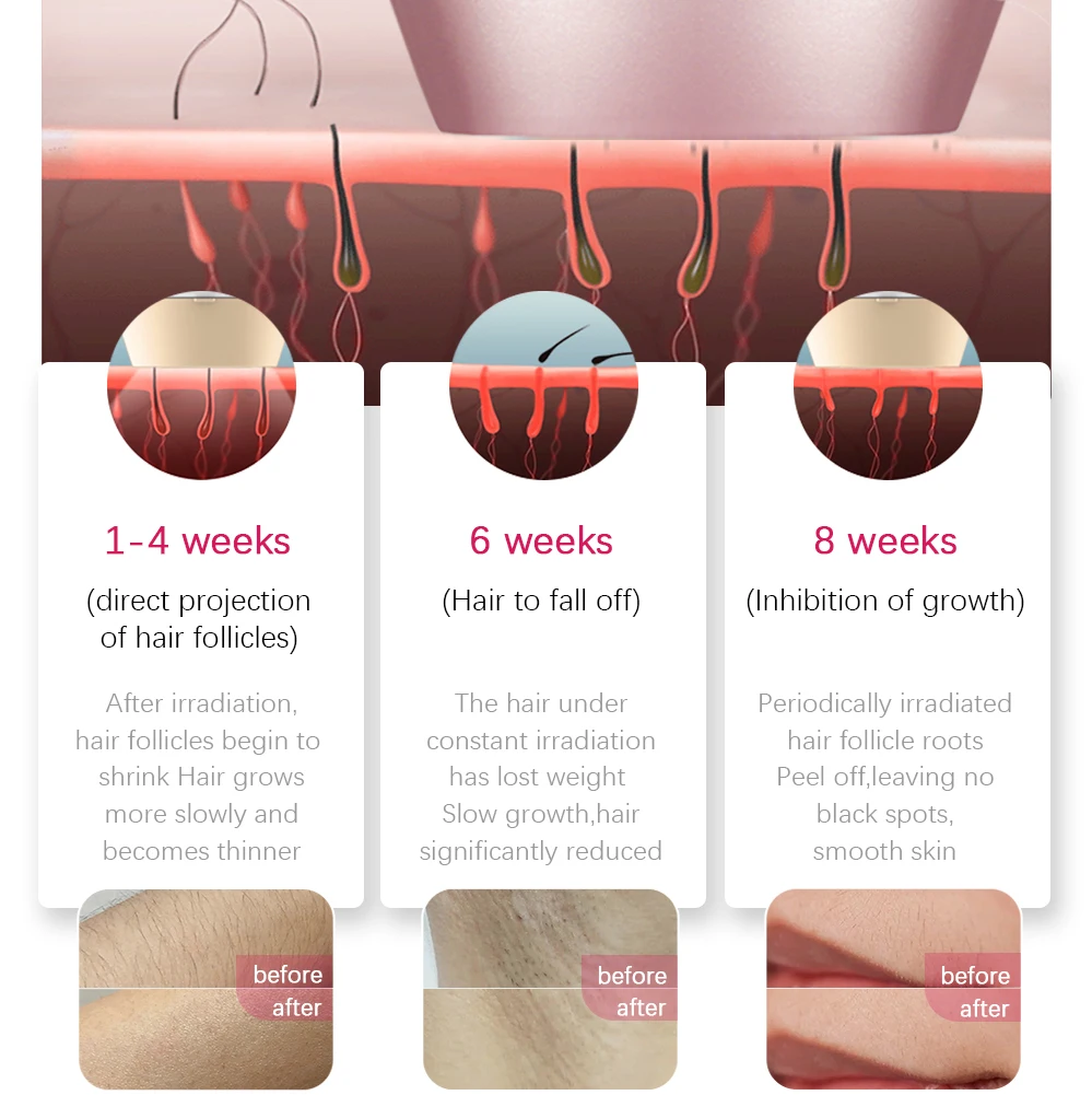 лазерный эпилятор IPL Эпилятор Лазерное Удаление Волос 3 В 1 Женщин Машина