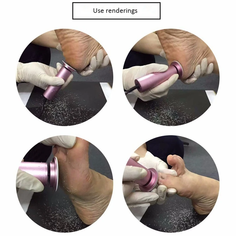 Rechargeable Sawing File for Feet Dead Skin Callus Peel Remover Electric Pedicure Foot Care Tool Files | Бытовая техника