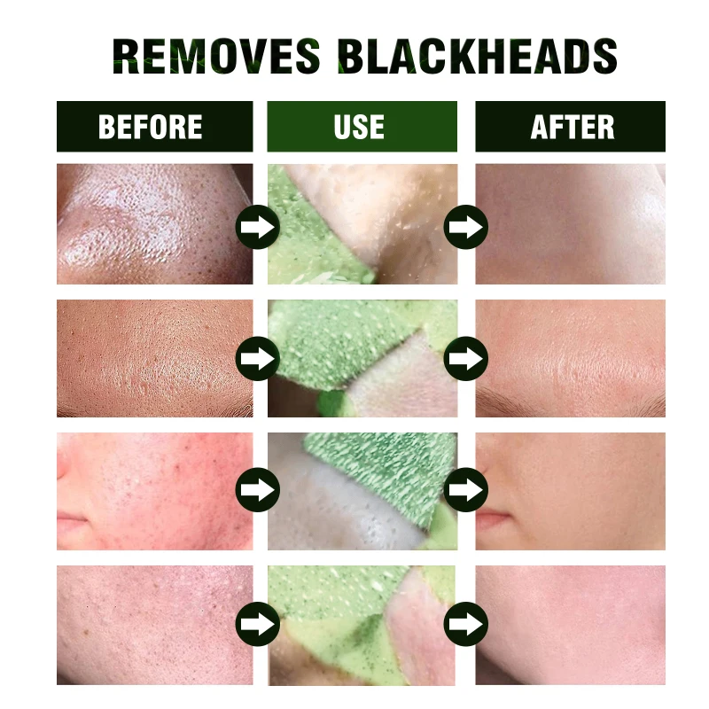 

Clay Mask Pore Black Dots Blackhead Deep Cleansing Mask Hydr