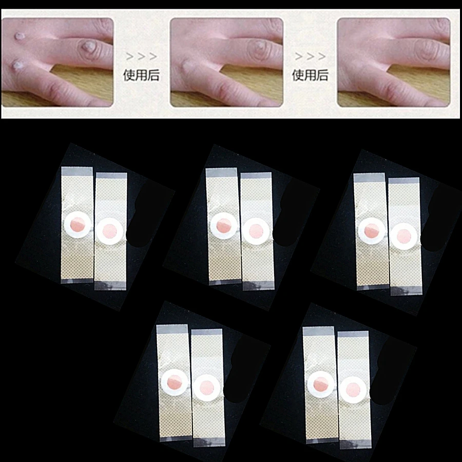 18 шт. китайские традиционные медицинские педикюрные наклейки в виде кокона