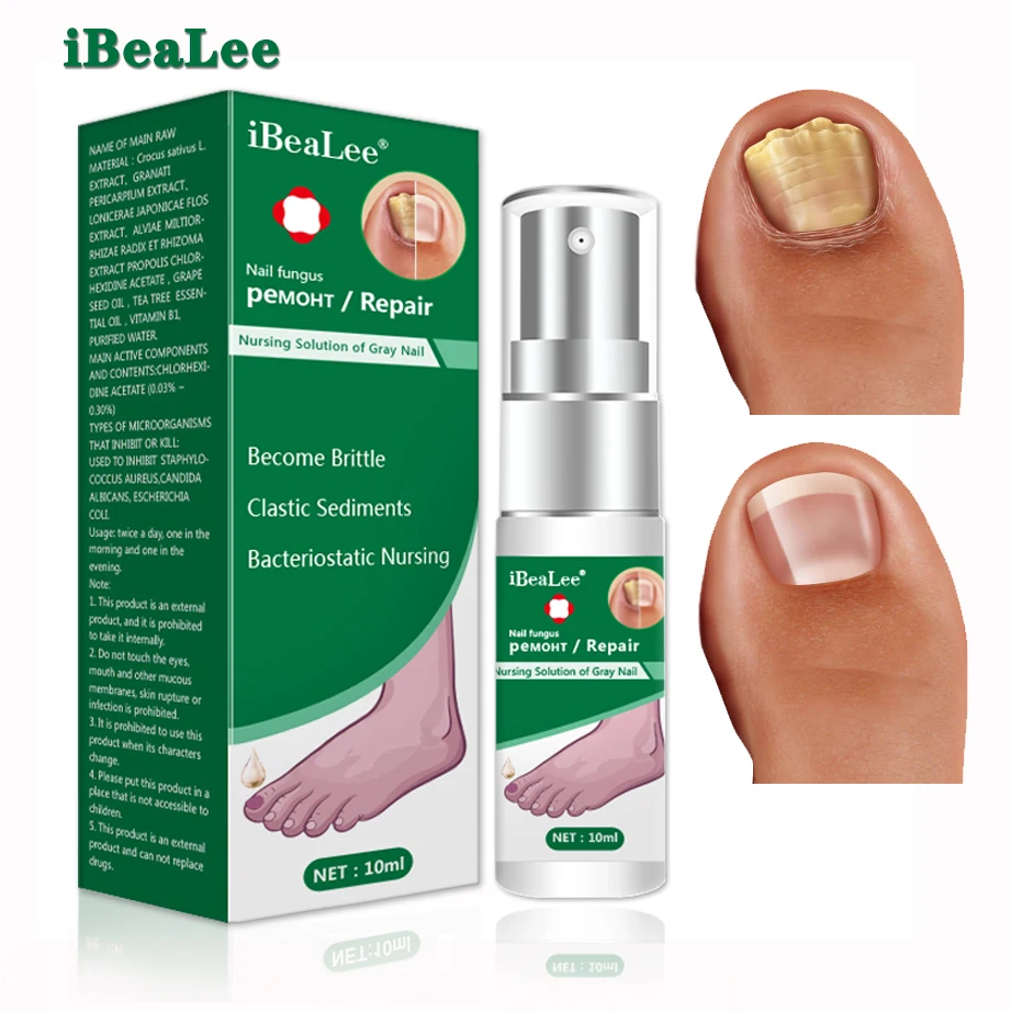 Средство для лечения грибка ногтей уход за ногами эссенция восстановления на