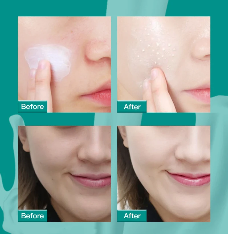 

Probiotics Moisturizing Rejuvenating Milk Cream Whitening Anti-aging Anti-wrinkle Moisturizing Cream Beauty Facial Treatment