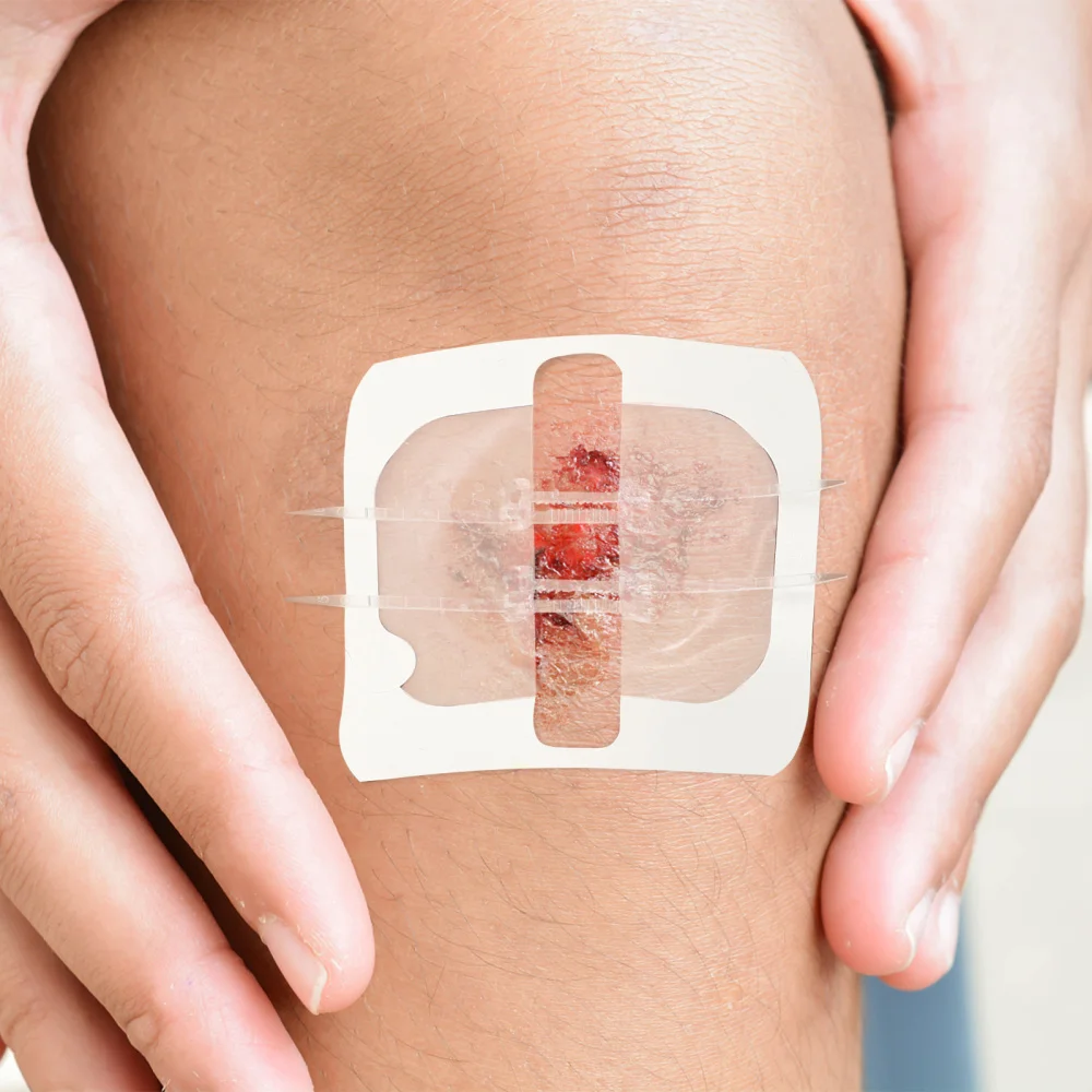 

2Pcs Professional Wound Closures Zipper Sticker Adhesive Zip Stitch Stickers