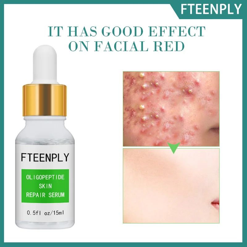 

FTEENPLY Oligopeptide кислота Сыворотки отбеливающий крем для лица против морщин Ремонт Увлажняющий Антивозрастной уход за кожей лица, сокращает пор...