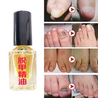 5ml 3 days effect removal liquid fungal nail treatment nail repair bright anti infection onychomycosis foot caring sick care