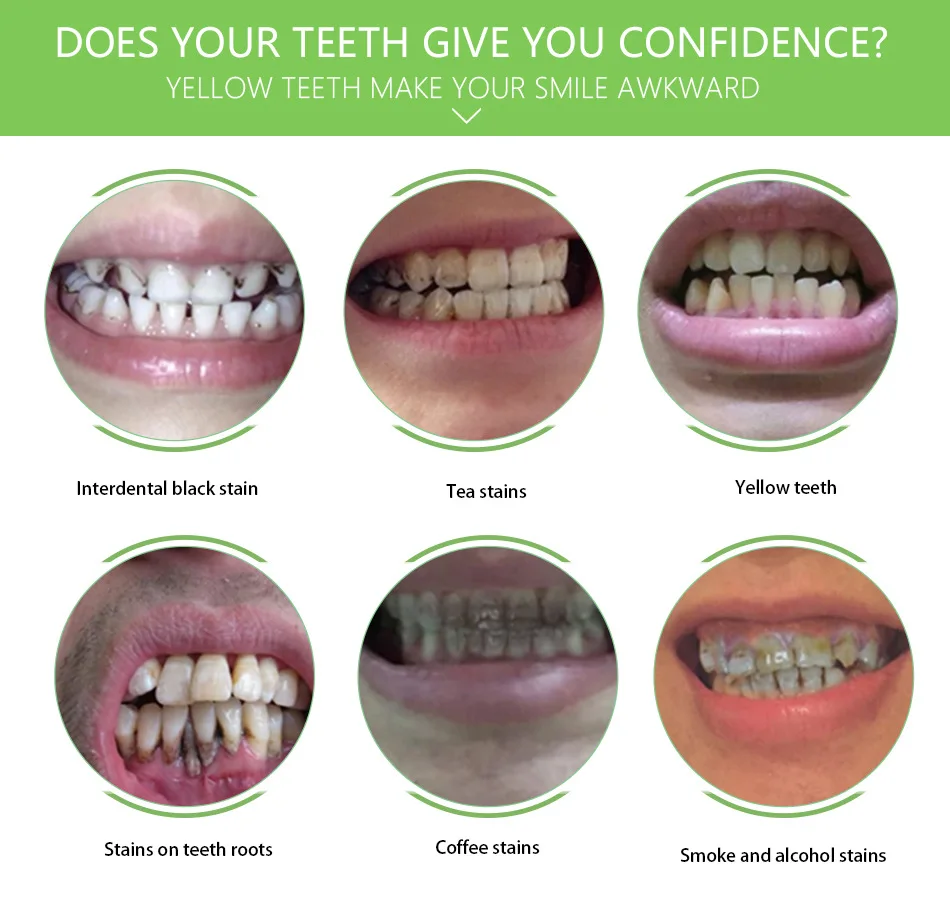 Отбеливающая эссенция для гигиены полости рта ежедневного использования