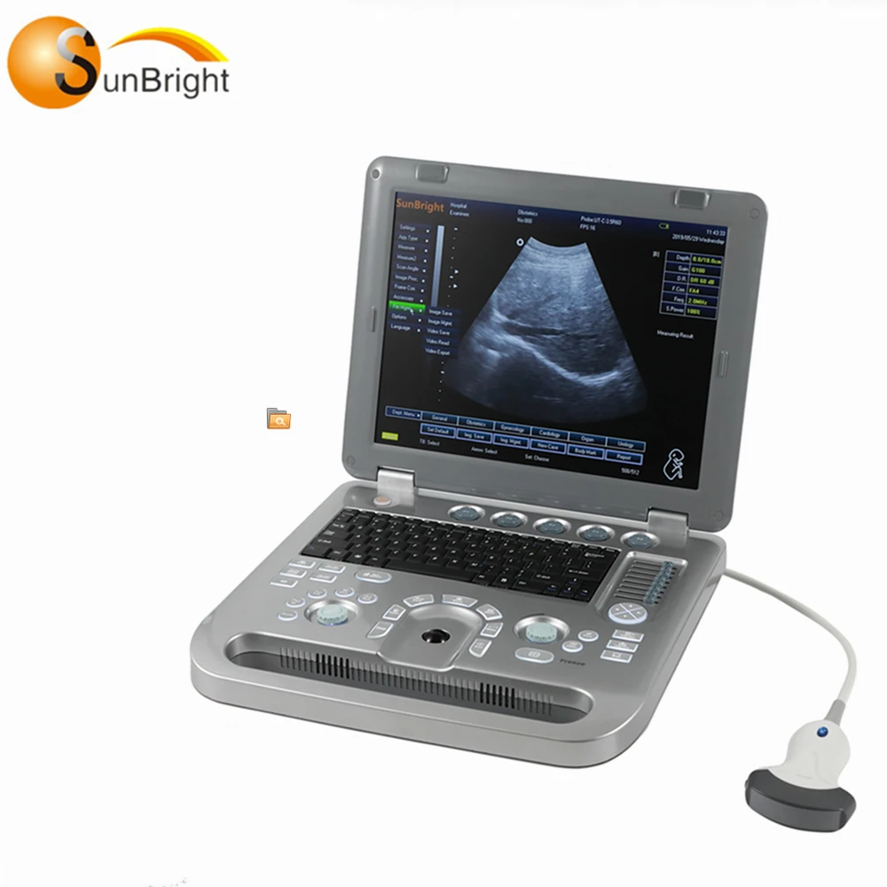 

Fetal 3d 4d portable color doppler ultrasound machine price