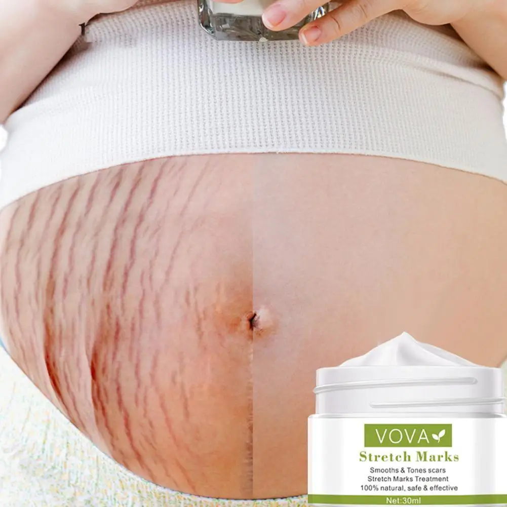 

Effective Remove Pregnancy Scars Acne Cream Stretch Marks Treatment Maternity Repair Anti-Aging Anti-Winkles Firming Body Creams