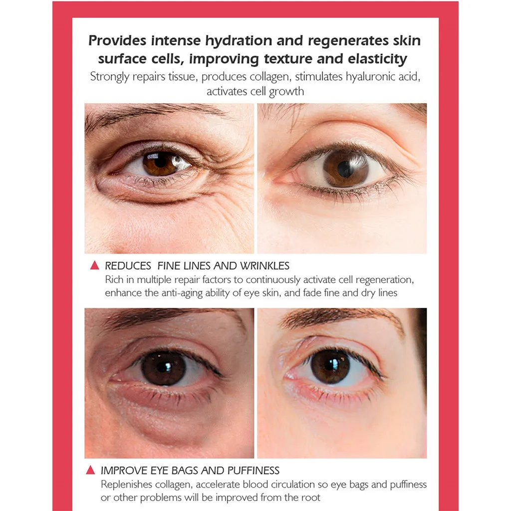 Крем для области вокруг глаз от Тёмных кругов припухлости и морщин| |