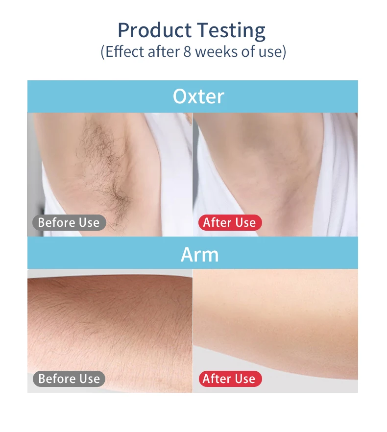 

Flashes 999990 Laser Epilator Painless 5in1 IPL Photon Hair Removal Facial Body Permanent Hair Device Electric Laser Epilator
