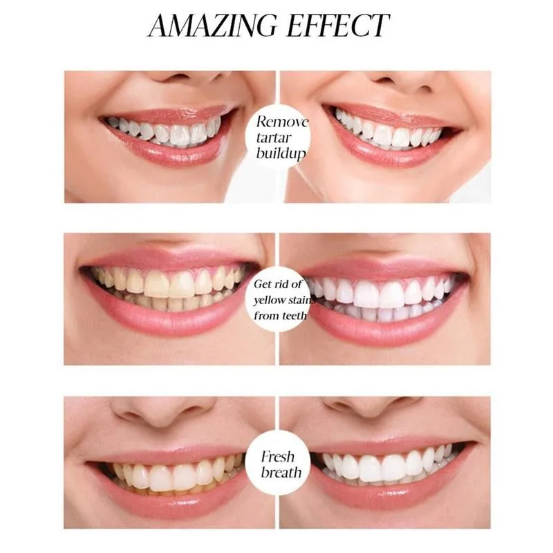 

Teeth Whitening Pen Oral Care Tooth Whitener Tooth Whitening Oral Hygiene Cleaning Teeth Cleaning Pen Oral Hygiene Tool Tee H6L3