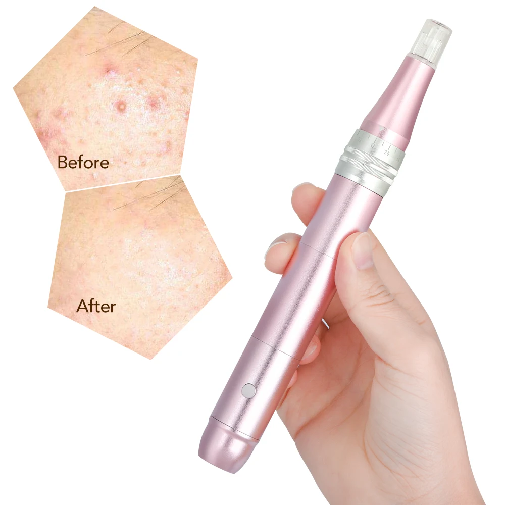 Electric Facial Roller Instrument Skin Tightening Remove Scar Reduce Wrinkles Professional Care Tools Beauty Device | Красота и