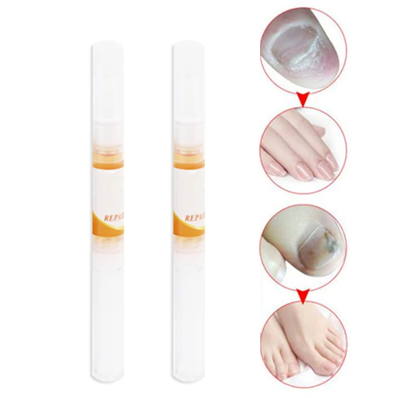 

2pcs Fingernail Toenail Repair Pen Nail Repair Pen Protects from Discoloration Brittle Crack MH88