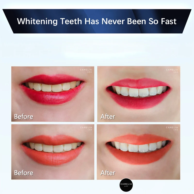 Crest 3D отбеливающие полоски с профессиональным сисветильник Том Отбеливающее
