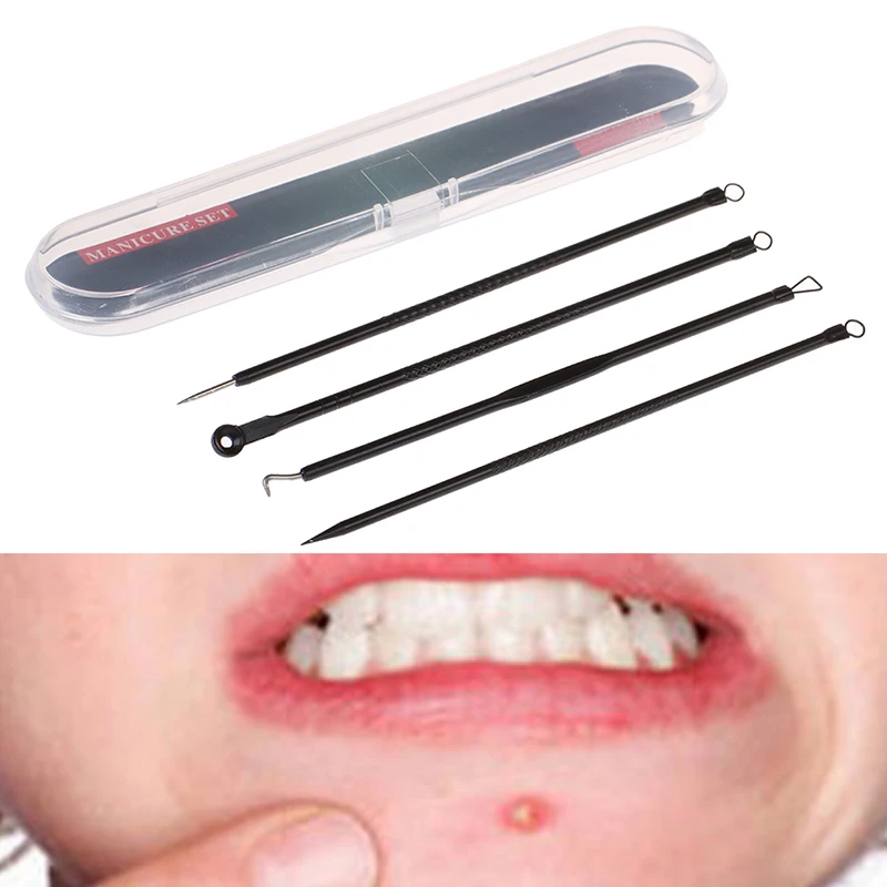 

4PCS Blackhead Extractor Cleaner Acne Remover Needles Set Stainless Black Spots Face Facial Cleanser Tools