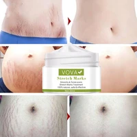 pregnant women to remove stretch marks body buttocks and chest lines effective skin care anti white stretch marks and scar cream