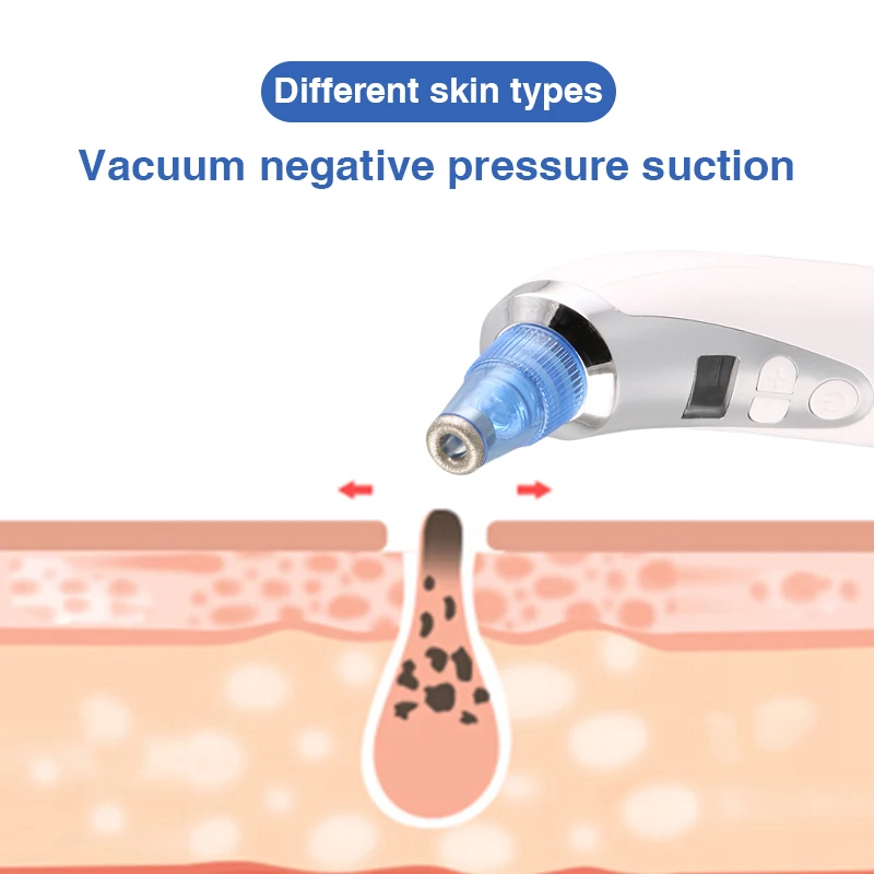 Электрический чистка лица пилинг для микрокристаллический пылесос удаления