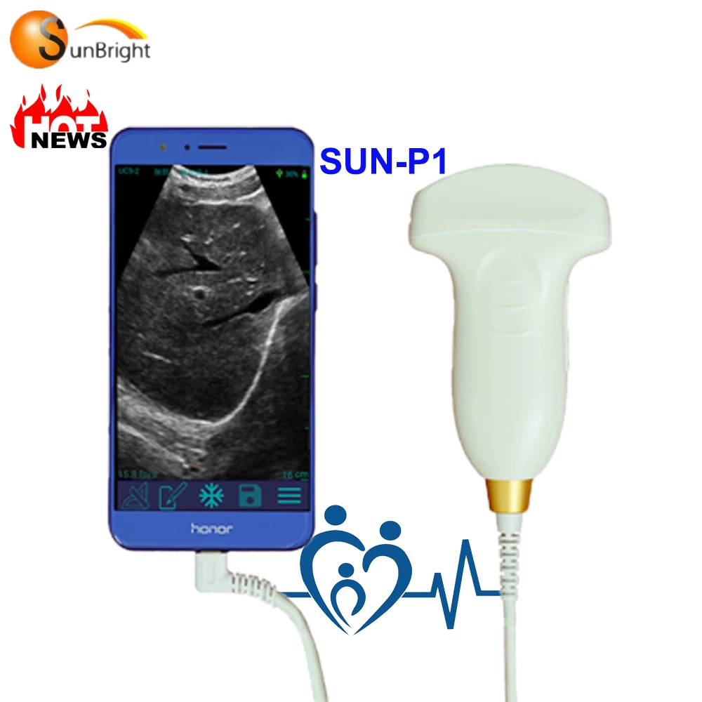 

smartphone ultrasound probe machine excellent price and quality
