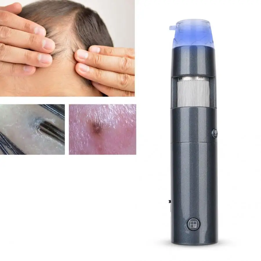 Беспроводной WI-FI кожи волос прибор для исследования волосистой части головы