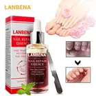 Средство LANBENA для лечения грибка ногтей с пилкой для удаления онихомикоза ногтей и пальцев ног, питание, осветление ногтей, Уход за ногтями TSLM1