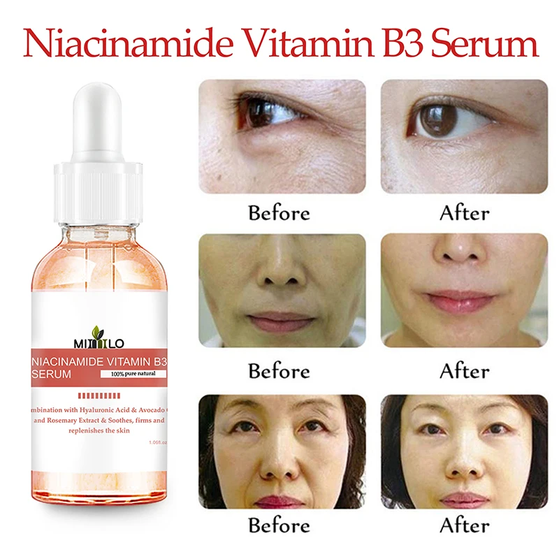 Сыворотка Niacinamide для лица Витамин В3 антивозрастной усадочный пор увлажняющий