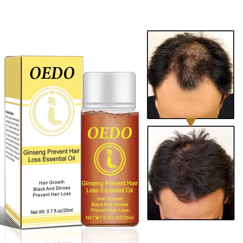 

0.7 Fl Oz/20ml Ginseng Prevent Hair Loss Product Hair Growth Essential Oil for Repairing Damaged Hair Care Treatments TSLM1