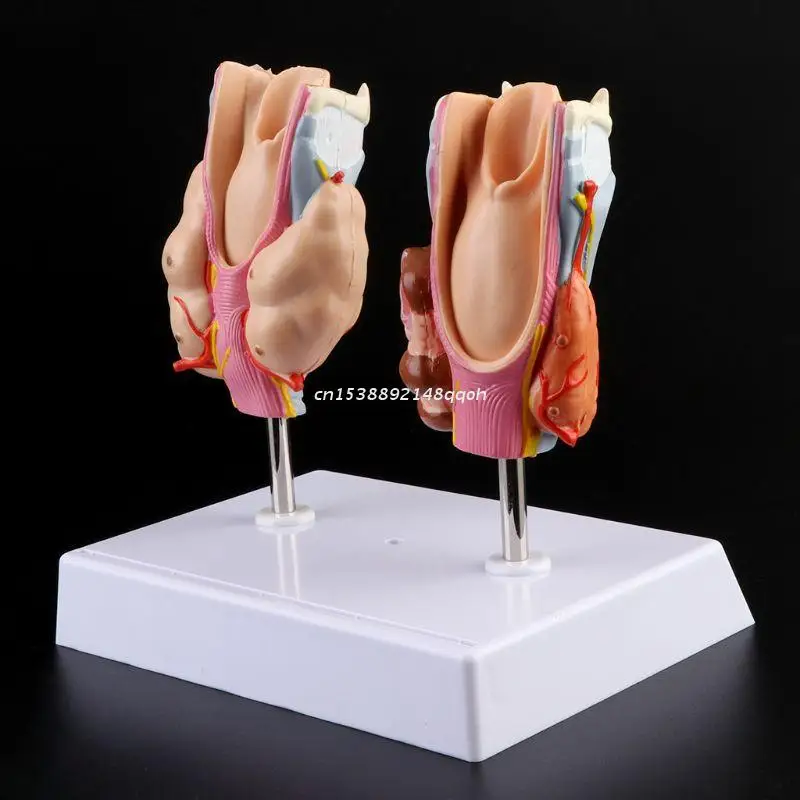 

Human Thyroid Anatomical Pathology Model Normal and Disease Pathologies Teaching Resource Tool Dropship