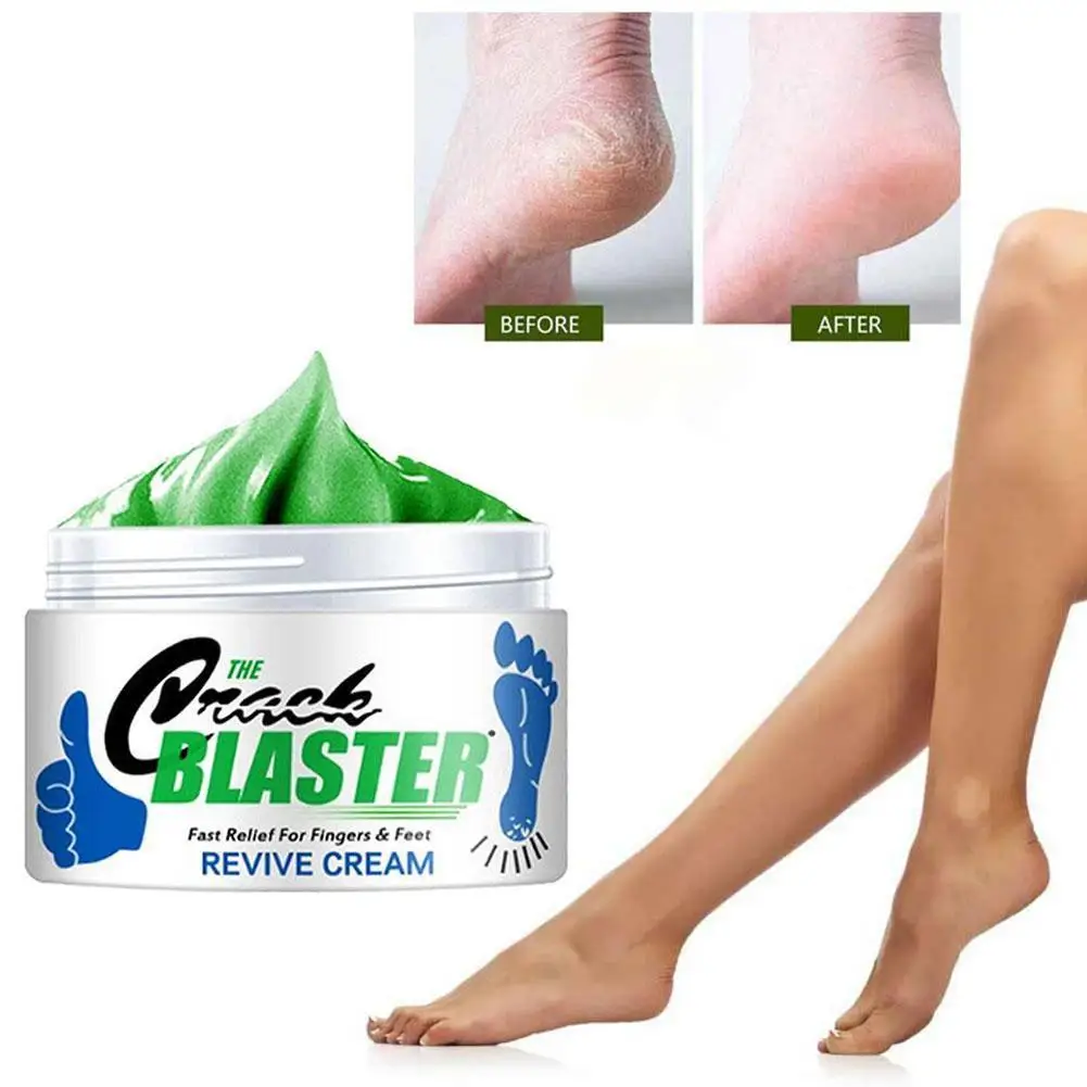 

Effective Hand Foot Crack Cream Heel Chapped Peeling Repair Frostbite Anti Dry Skin Creams Nourishing Anti Cracking Repair Cream