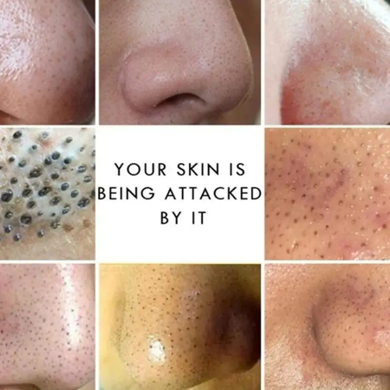 

Active Energy Bamboo Drug Bactericidal Soap Tourmaline Soap Blackhead Remover Oil-control for Femal Face Hand Body Healthy Care