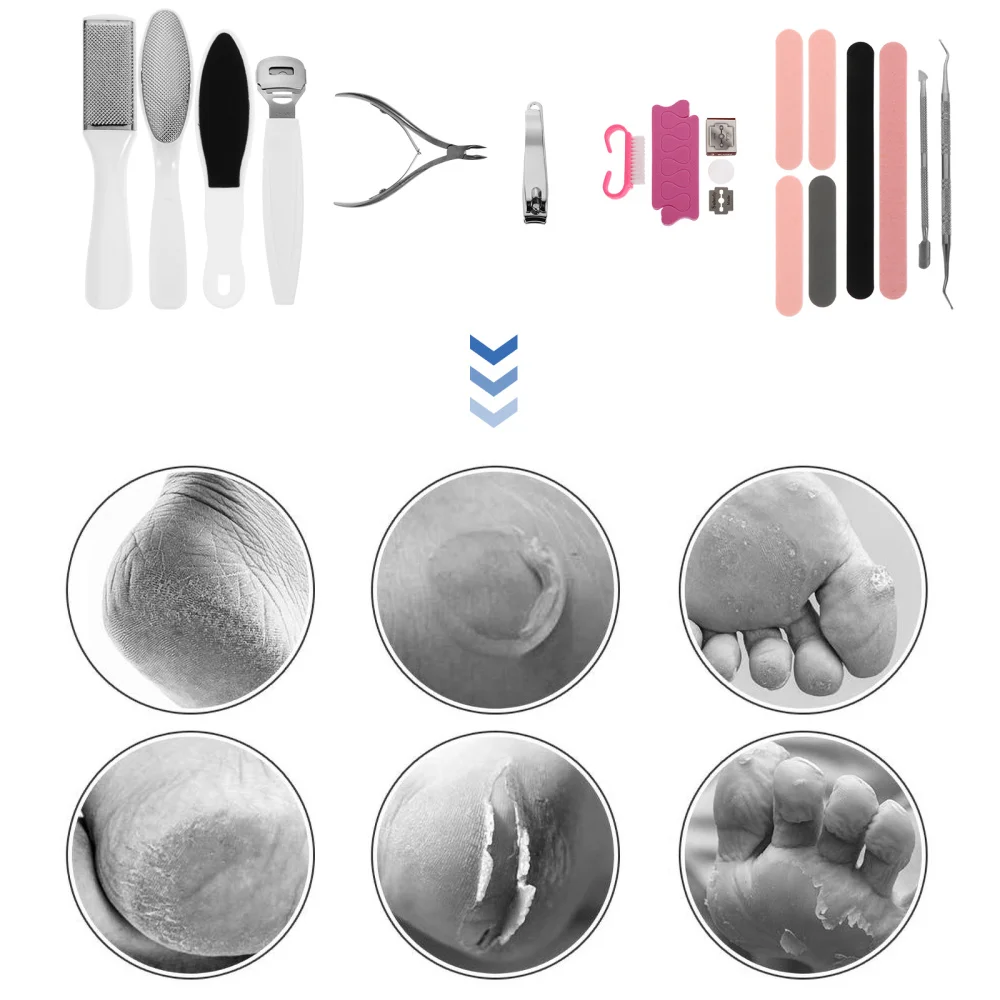 

20Pcs Foot File Callus Remover Dead Foot Skin Remover Feet Care Pedicure Tools