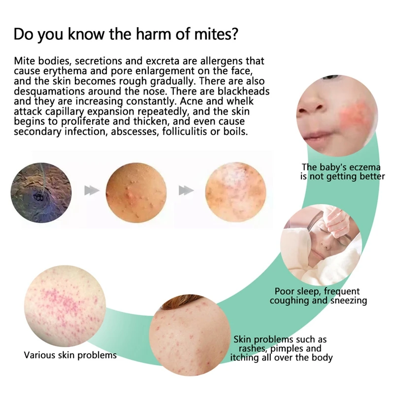 

6 Pcs Natural Mite Killer Removal of Acarid By Home Use of Acarid Removal Pack Pregnant Women Baby Bed Bugs Cleaner