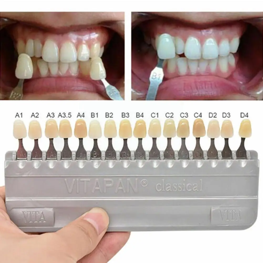 

3d Tooth Comparator 16 Colors Tooth Guide Tooth Plate Chart Bleaching Plate Color Plate Tooth Whitening Teeth Shadow Whiten I2z6