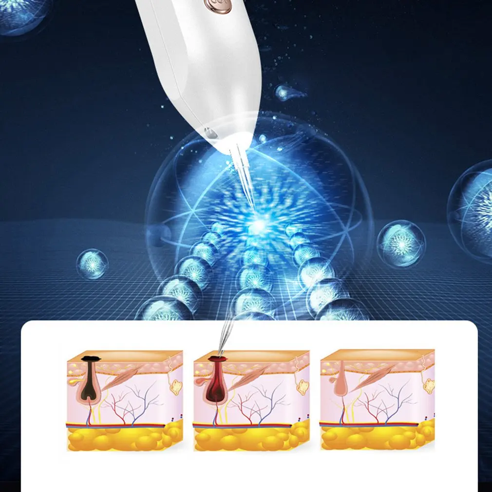 Плазменная ручка моль татуировки веснушки тег для удаления пера темное пятно