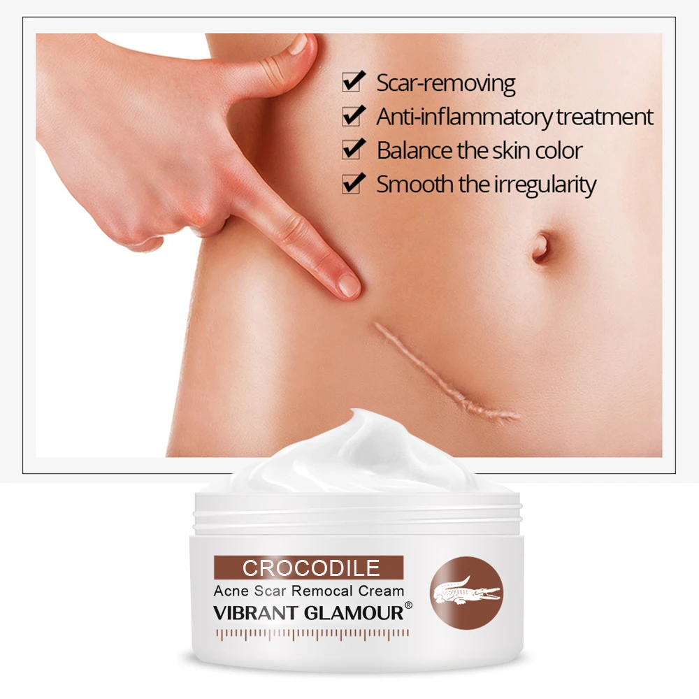 Яркие Гламурные крем для лица из крокодиловой кожи ремонт шрам анти против
