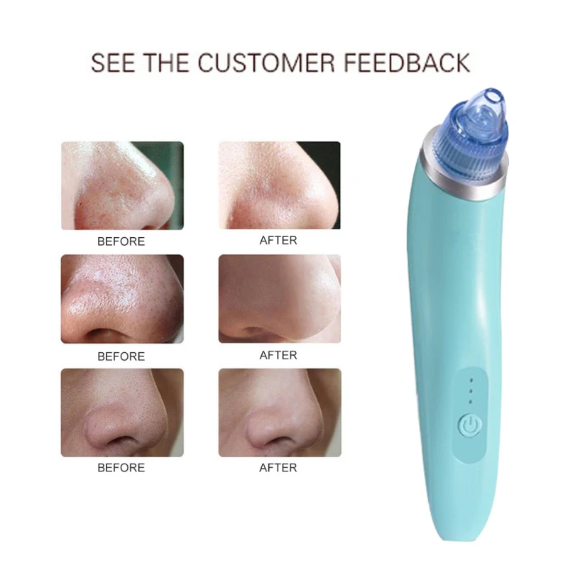 Инструменты для очищения лица вакуумный отсос угрей алмазный пилинг Wrink акне пор