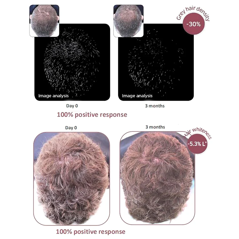 Спрей для роста волос и бороды стимулятор уход за бородой Питательная Жидкость