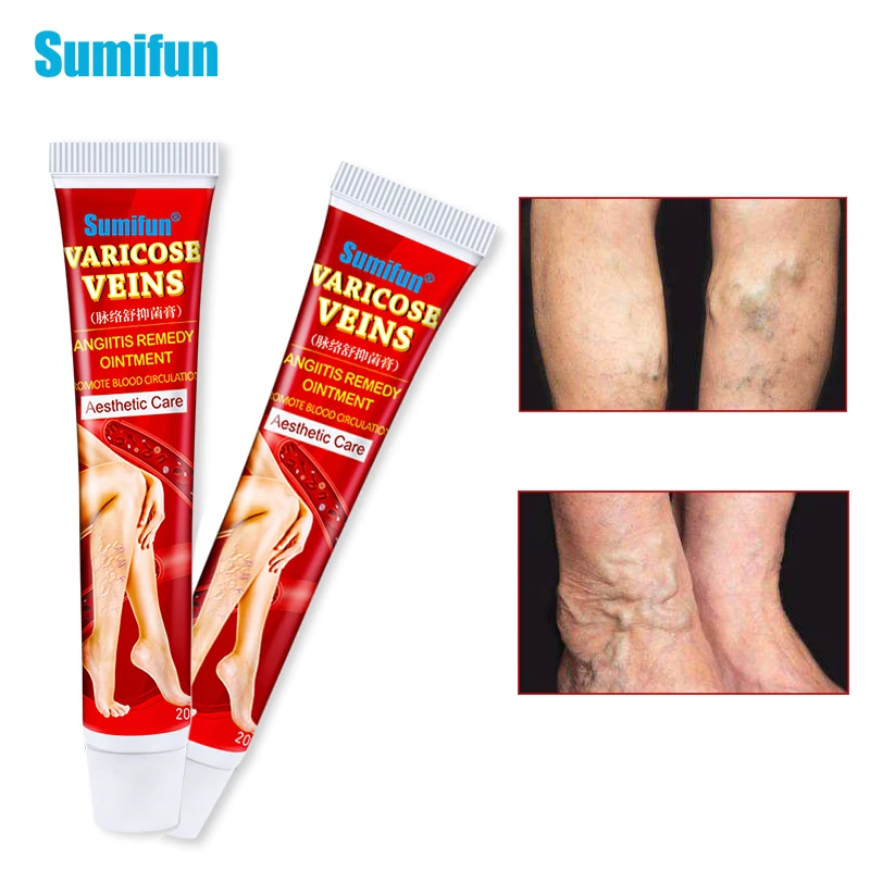 

1/2Ppcs 20G Sumifun Varicose Veins Treatment Cream Original Vasculitis Phlebitis Spider Pain Relief Ointment Medical Plaster