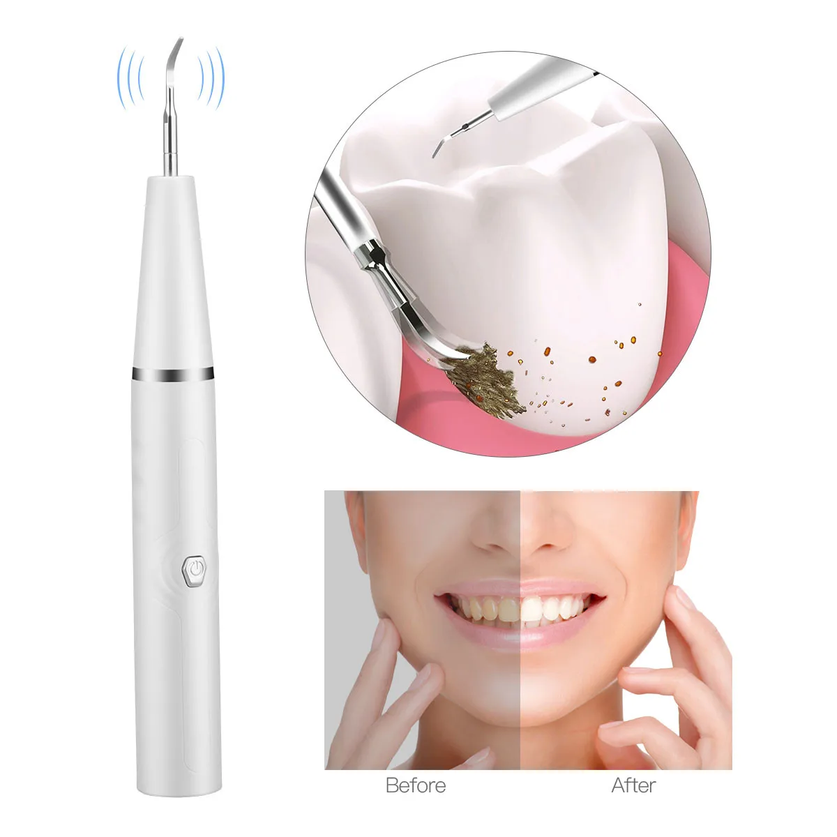 

CkeyiN Electric Ultrasonic Sonic Dental Scaler Waterproof Tooth Calculus Tartar Remover USB charging Whiten Teeth Cleaner Tools