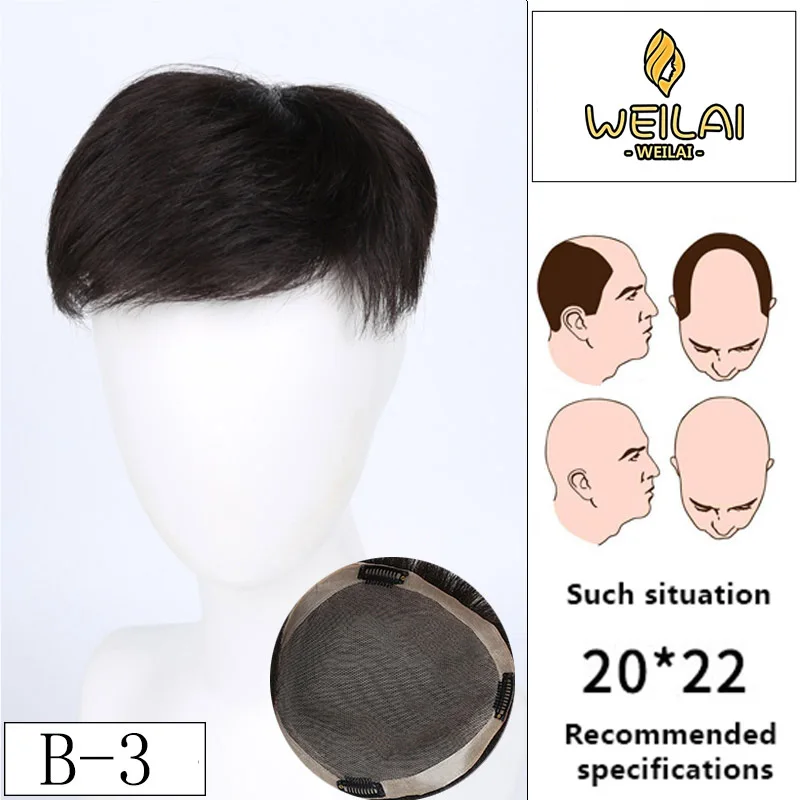 Искусственные волосы JINJIAN для мужчин имитирующие редкие на макушке выпадение